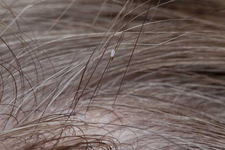 lice in black hair